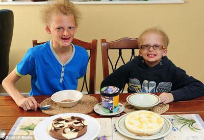 Ошибки природы: люди с редкими заболеваниями