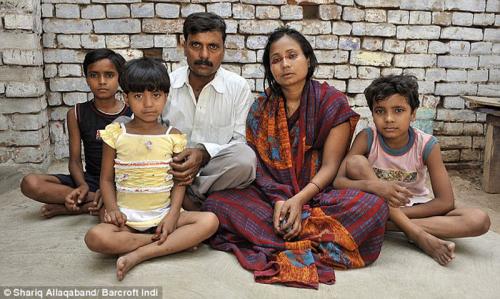 Ошибки природы: люди с редкими заболеваниями