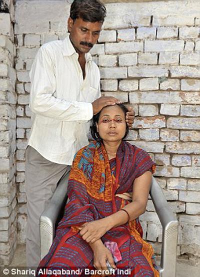 Ошибки природы: люди с редкими заболеваниями