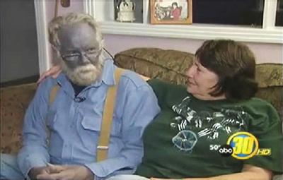 Ошибки природы: люди с редкими заболеваниями