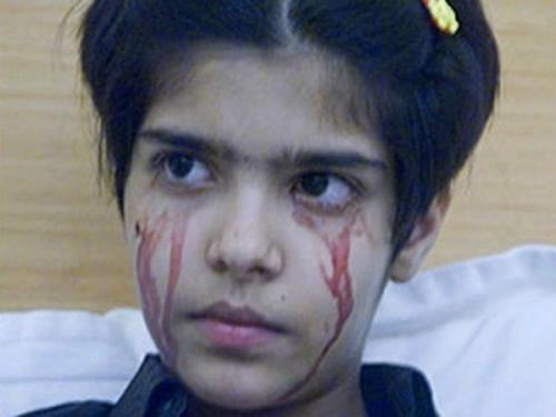 Ошибки природы: люди с редкими заболеваниями