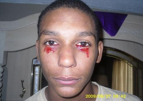 Ошибки природы: люди с редкими заболеваниями