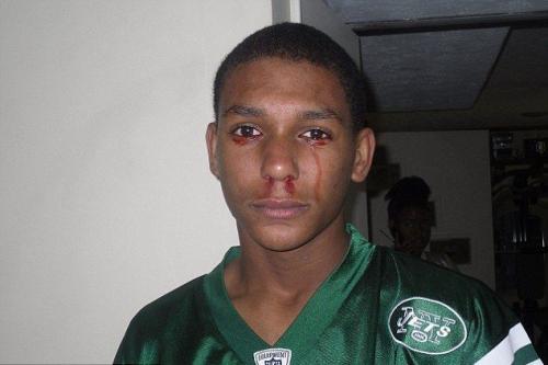 Ошибки природы: люди с редкими заболеваниями