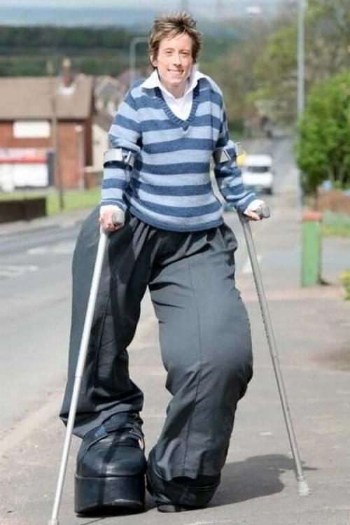 Ошибки природы: люди с редкими заболеваниями