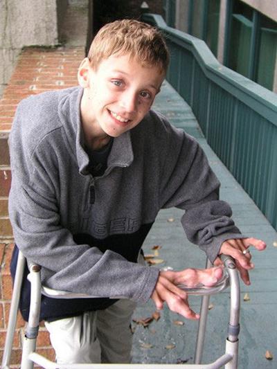 Ошибки природы: люди с редкими заболеваниями