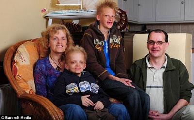 Ошибки природы: люди с редкими заболеваниями