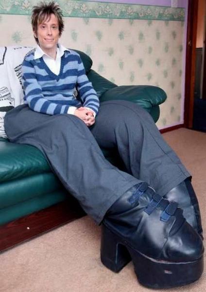 Ошибки природы: люди с редкими заболеваниями