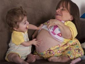 Самая маленькая мать в мире ждет третьего ребенка