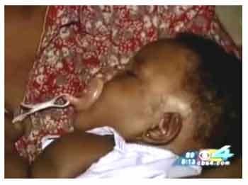 Самый крошечные младенцы в мире: какими они вырастают