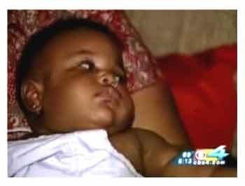 Самый крошечные младенцы в мире: какими они вырастают