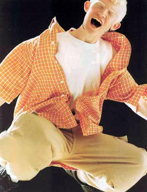 Альбинизм — дар или проклятие?