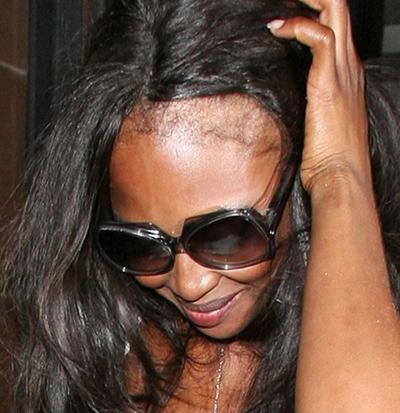 Лысеющая Наоми Кэмпбелл: конфуз за конфузом