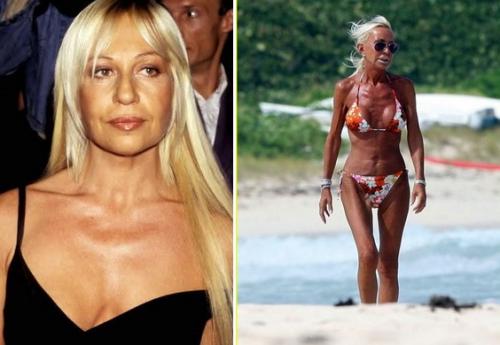 Фото звезд, которые стали шоком для их поклонников