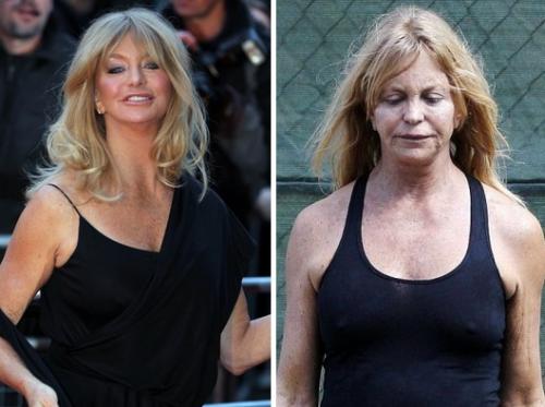 Фото звезд, которые стали шоком для их поклонников