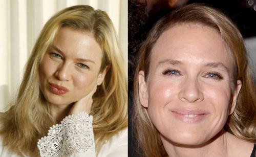 Фото звезд, которые стали шоком для их поклонников