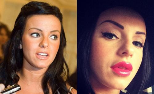 Фото звезд, которые стали шоком для их поклонников