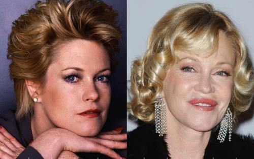 Фото звезд, которые стали шоком для их поклонников