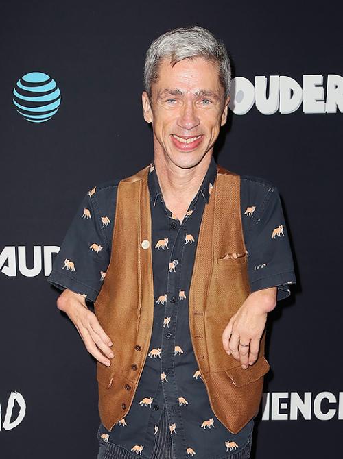 Истории актеров с нестандартной внешностью