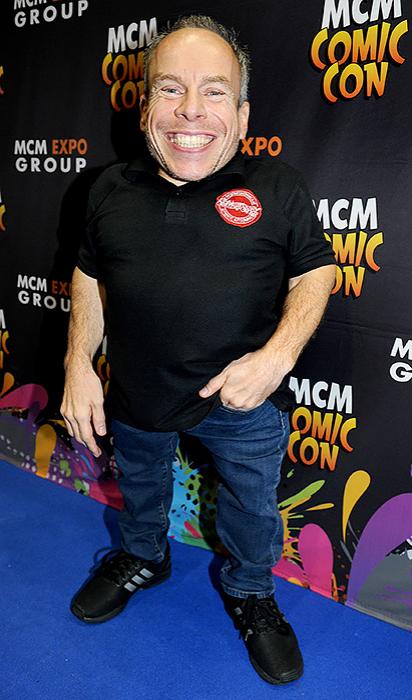 Истории актеров с нестандартной внешностью