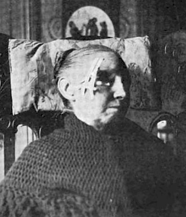 Пугающее медицинское оборудование прошлого, которое больше похоже на орудие пыток