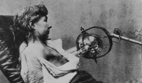 Пугающее медицинское оборудование прошлого, которое больше похоже на орудие пыток