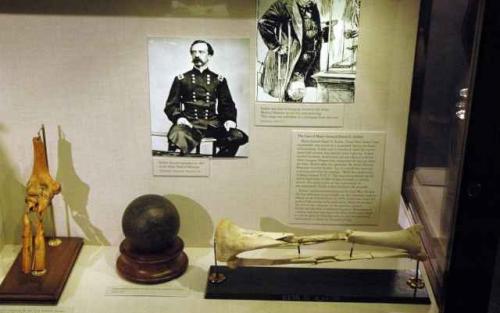 Части тела людей, жившие самостоятельной жизнью