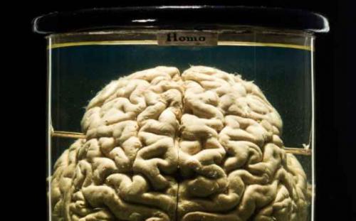 Части тела людей, жившие самостоятельной жизнью