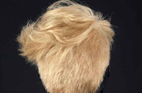 Части тела людей, жившие самостоятельной жизнью