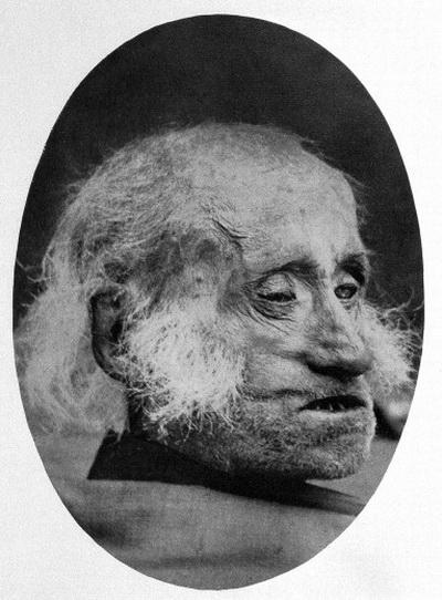 Части тела людей, жившие самостоятельной жизнью