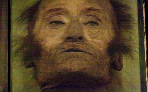 Части тела людей, жившие самостоятельной жизнью