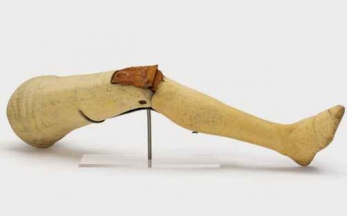 Части тела людей, жившие самостоятельной жизнью