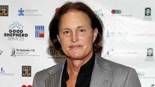 Самые известные топ-модели, бывшие мужчинами