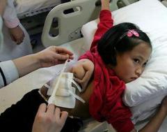 В Китае прооперировали девочку с рукой на спине