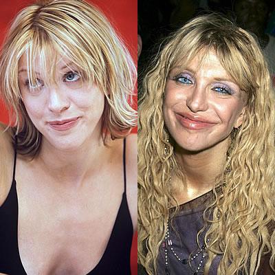 10 знаменитостей, которые сильно пожалели о сделанных пластических операциях