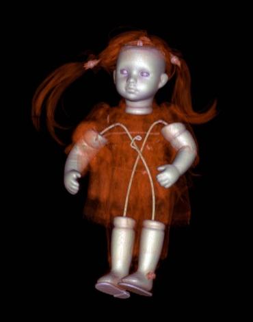 Студент-медик открывает мир через рентгеновские снимки