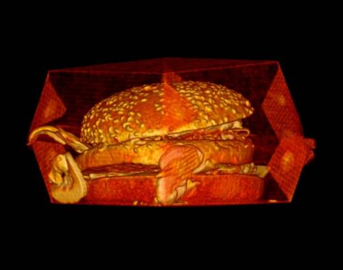 Студент-медик открывает мир через рентгеновские снимки