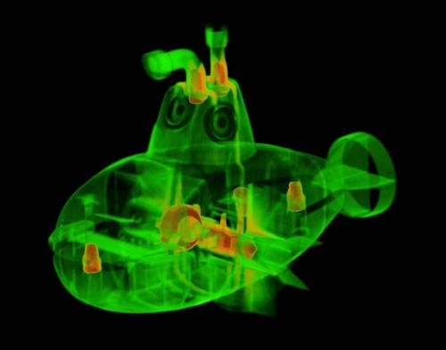 Студент-медик открывает мир через рентгеновские снимки