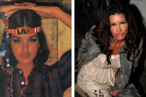 Звёзды, проигравшие битву с возрастом