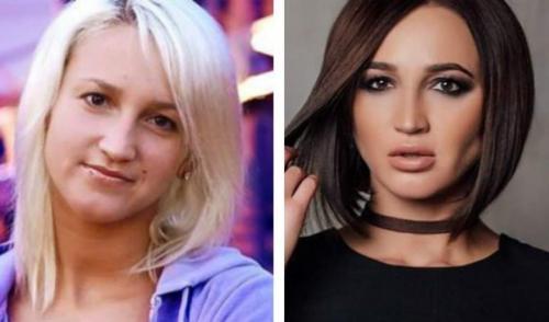 10 звёзд, которые кардинально изменили внешность