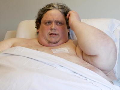 Самый толстый мужчина в мире сел на диету