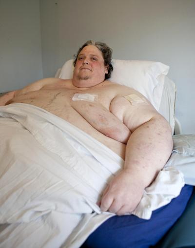 Самый толстый мужчина в мире сел на диету