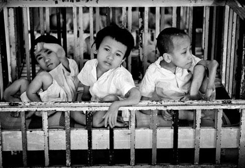 Жертвы яда «номер 1»: спустя десятилетия во Вьетнаме рождаются дети-уроды