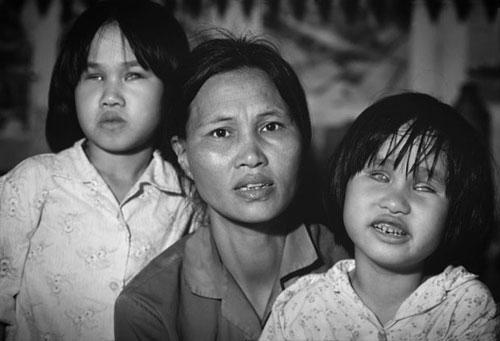 Жертвы яда «номер 1»: спустя десятилетия во Вьетнаме рождаются дети-уроды