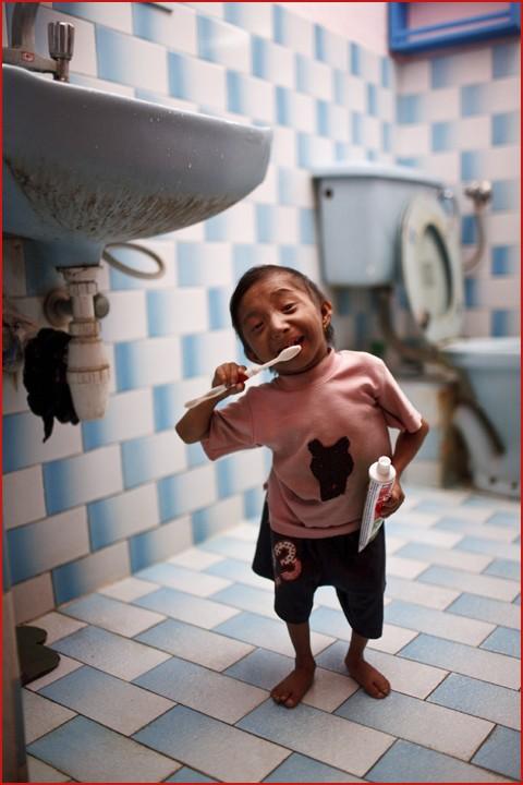 Самому маленькому в мире человеку исполнилось 18 лет