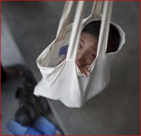 Самому маленькому в мире человеку исполнилось 18 лет