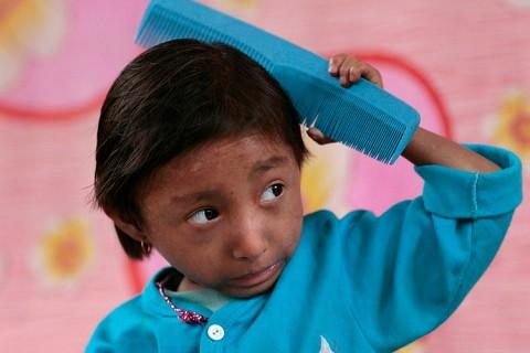 Самому маленькому в мире человеку исполнилось 18 лет