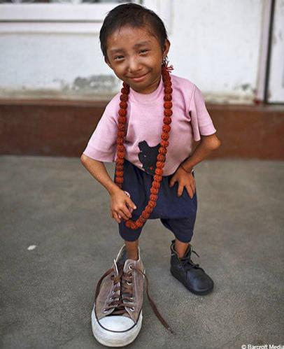 Самому маленькому в мире человеку исполнилось 18 лет