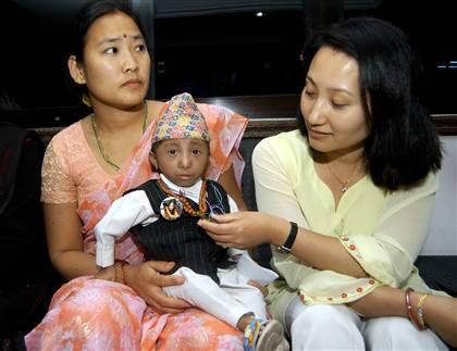 Самому маленькому в мире человеку исполнилось 18 лет