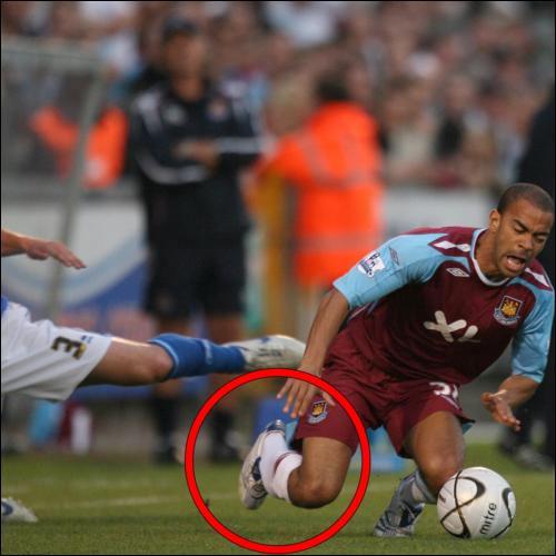 Самые кошмарные футбольные травмы