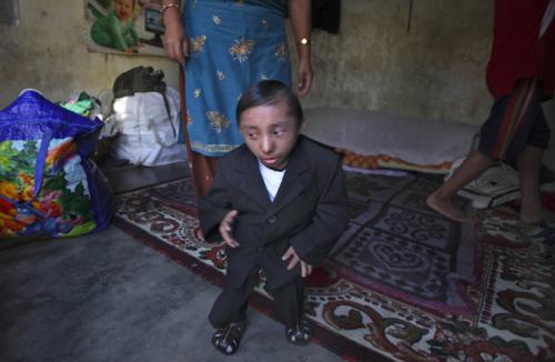 Самый маленький человек в мире готовится к принятию титула